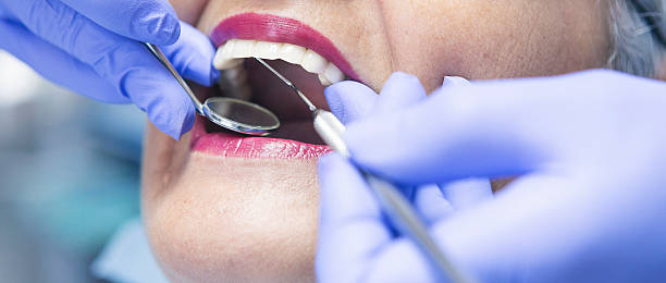 Best Broken or Cracked Tooth Emergency Dentist in Skyline, AL
